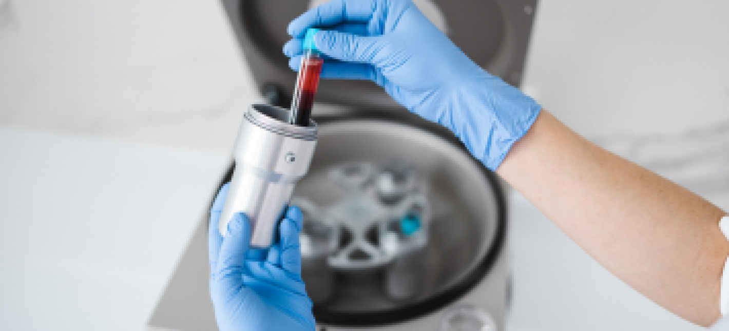 Плазмотерапия (PRP) в ортопедии